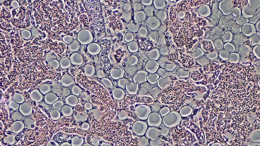 Proliferation of Adipocytes in Adult Parathyroid Gland by Phase Contrast
